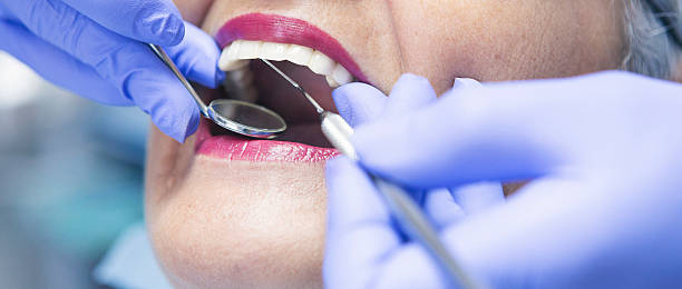 Best Emergency Root Canal Treatment in Long Lake, IL